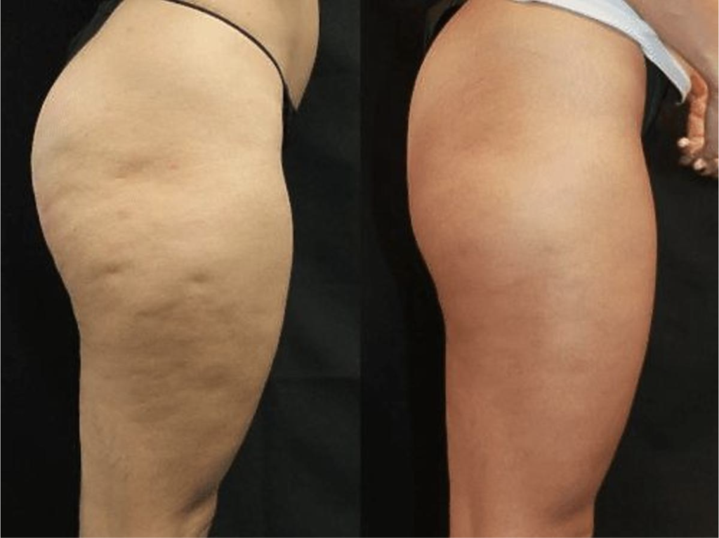 3fb4804a95a11dd37ad966b742264fa1.png 3fb4804a95a11dd37ad966b742264fa1.png